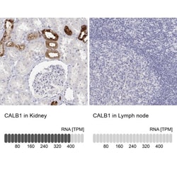 Calbindin D-28K Antibody, Novus Biologicals:Antibodies:Primary Antibodies
